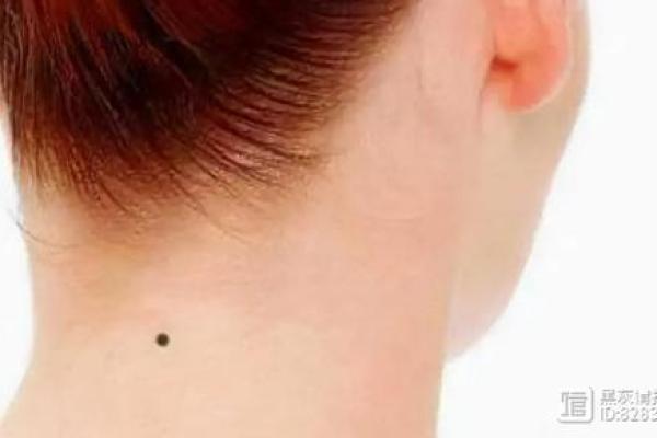 命运之痣：左膝盖上的那颗痣，究竟有何寓意？