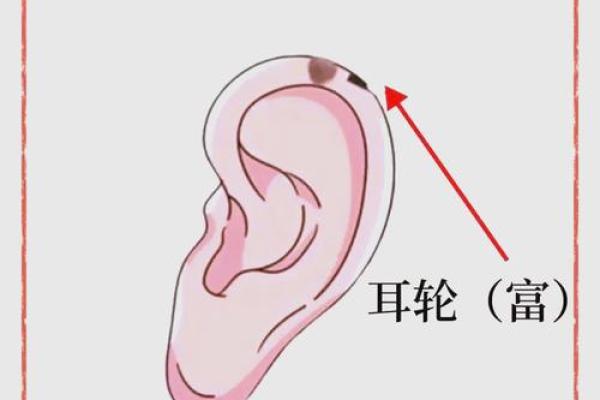 痔相女子左耳垂痣，竟隐藏着这样的秘密！